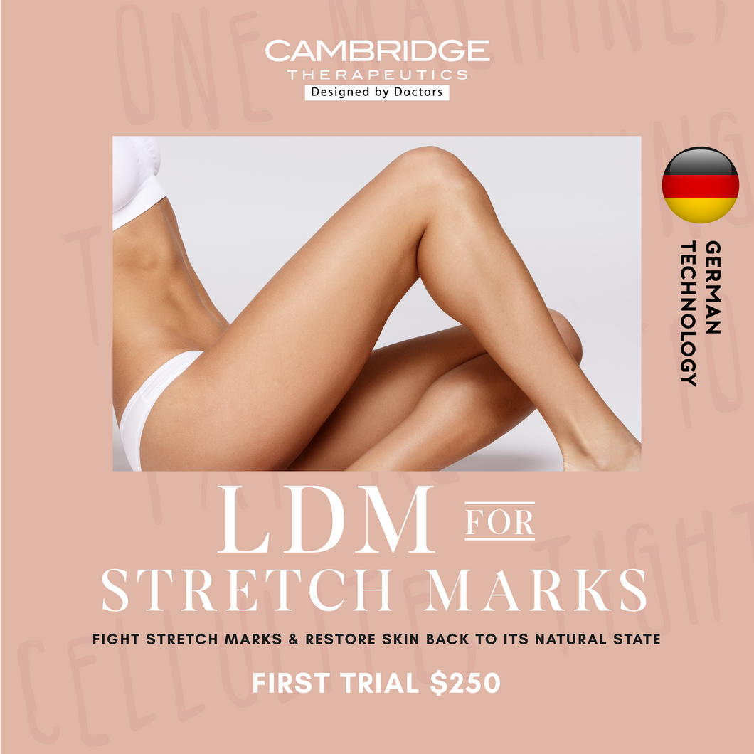 LDM (STRETCH MARKS)